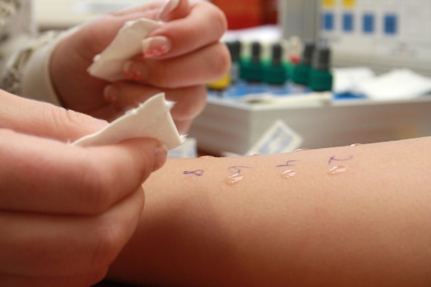 Persona colocando papel sobre el brazo de otra, representando asistencia y cuidado en tratamientos de cáncer.